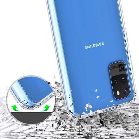 Smcase Samsung Galaxy S20 Ultra Kılıf Magic Kristal Sert Silikon