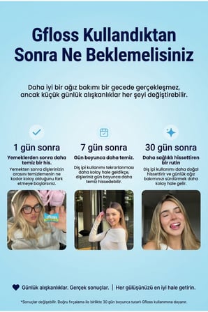 Gfloss Elsiz Diş İpi 120 Adet, Tek Tek Ambalajlı, Hijyenik Tekli Paket, Aromasız