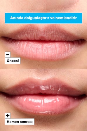 Vital Hydra Solution™ Bubble Gum Nemlendirici Dudak Maskesi