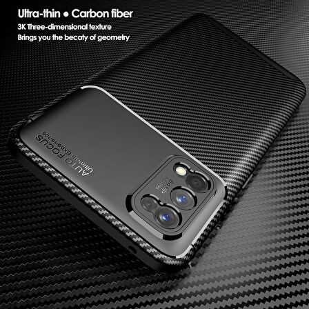 Smcase Realme 7 Pro Kılıf Negro Karbon Dokulu Silikon