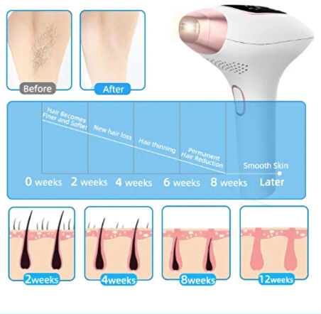 nwn3 Acısız IPL Buz Lazer Epilasyon Cihazı 999.999 Flaş Atım Tüm Vücut - Yüz