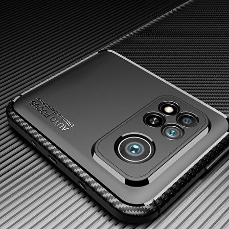 Smcase Xiaomi Mi10T Kılıf Negro Karbon Dokulu Silikon  Nano Ekran Koruyucu