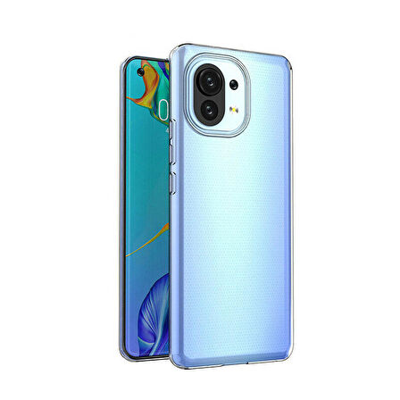 Smcase Xiaomi Mi 11 Lite Kılıf Lüks Korumalı Tpu Silikon 