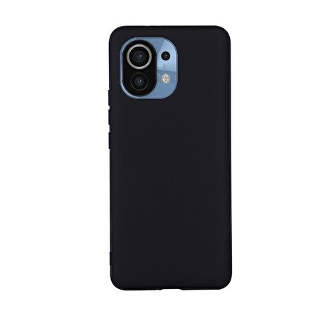 Smcase Xiaomi Mi 11 Lite Kılıf Lüks Mat Biye Tpu Silikon  Nano Ekran Koruyucu