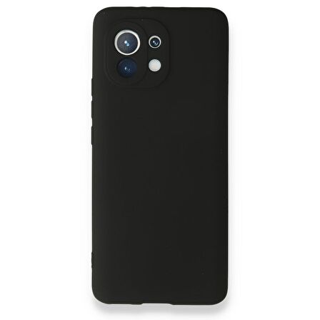 Smcase Xiaomi Mi 11 Lite Kılıf Kamera Korumalı Premier Silikon  Nano Ekran Koruyucu 