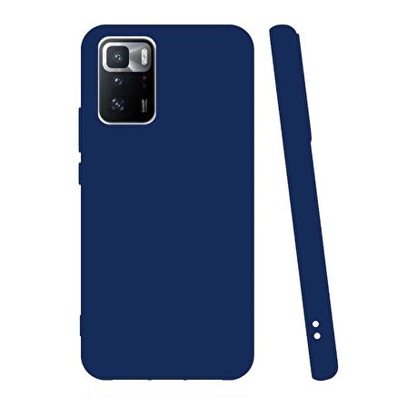 Smcase Xiaomi Poco X3 GT Kılıf Mat Korumalı Biye Silikon