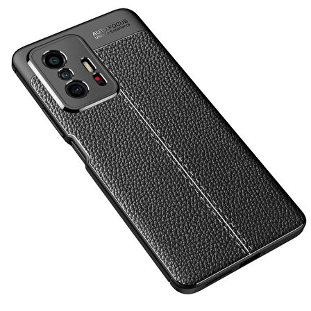 Smcase Xiaomi 11T Kılıf Kamera Korumalı Deri Dokulu Silikon  Nano Ekran Koruyucu