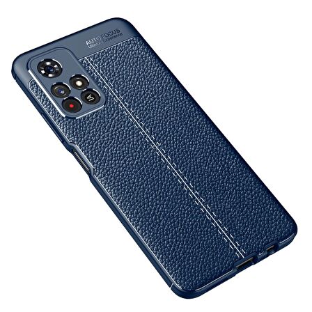 Smcase Xiaomi Poco M4 Pro 5G Kılıf Kamera Korumalı Deri Dokulu Silikon  Nano Ekran Koruyucu