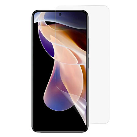Smcase Xiaomi Poco M4 Pro 5G Kılıf Kamera Korumalı Deri Dokulu Silikon  Nano Ekran Koruyucu