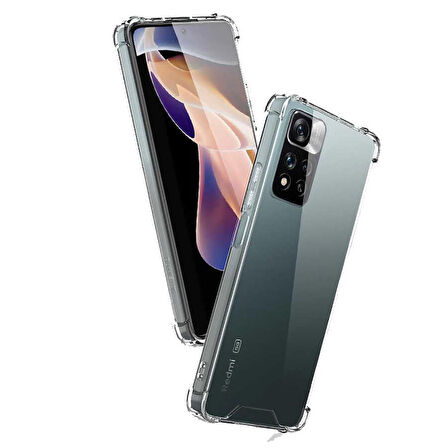Smcase Xiaomi Redmi Note 11 Pro Kılıf Darbe Korumalı Silikon  Nano Ekran Koruyucu