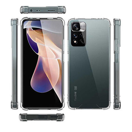 Smcase Xiaomi Redmi Note 11 Pro Kılıf Darbe Korumalı Silikon  Nano Ekran Koruyucu