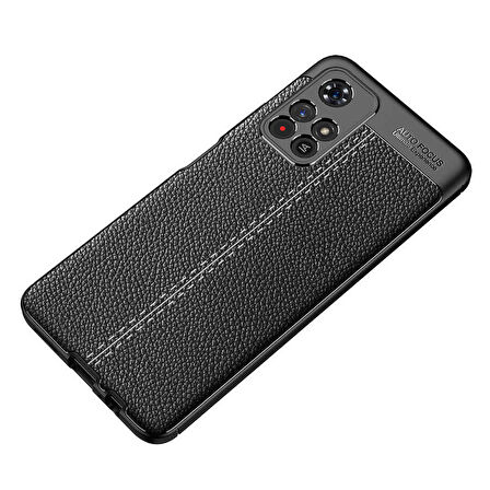 Smcase Xiaomi Redmi Note 11 5G Kılıf Kamera Korumalı Deri Dokulu Silikon