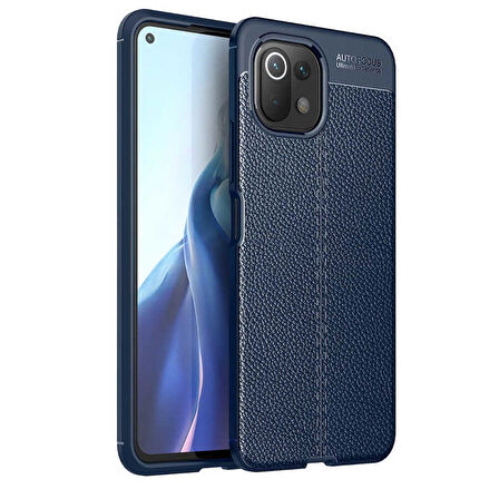 Smcase Xiaomi Mi 11 Lite Kılıf Lüks Korumalı Deri Dokulu Silikon 