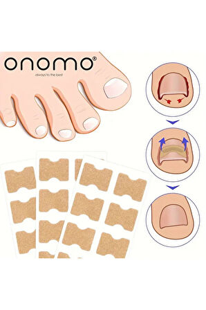 Health Ayak Batık Tırnak Düzeltme Bandı 50 Adet