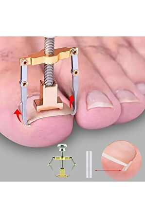 Health Batık Tırnak Düzeltici Batık Tırnak Çıkartıcı Aparat ve Batma Engelleyici Çubuk