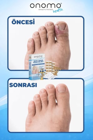 Health Batık Tırnak Düzeltme Seti 61 Adet
