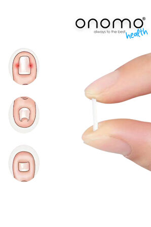 Onomo Health Batık Tırnak Düzeltici Şerit 10 Adet