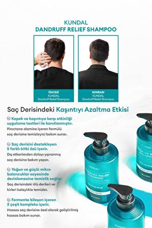 Kepek Karşıtı Bakım Şampuanı %68.5 Daha Az Kepek KUNDAL Dandruff Shampoo 500ml (White Musk)