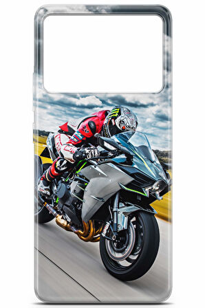Xiaomi Poco X6 Pro uyumlu Otomoto 36 HD Koruma Süper Hızlı Motor