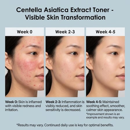 Centella Asiatica Tonik – Yatıştırıcı, Nemlendirici ve Bariyer Destekleyici Cilt Toniği, Hassas Ciltler için, 250 ML
