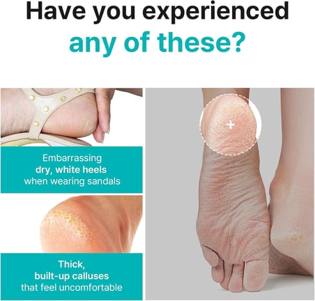 Smooth & Pure Foot Peeling Mask Purifying 2 pairs - Derinlemesine Arındırıcı Ayak Peeling Maskesi 2 çift