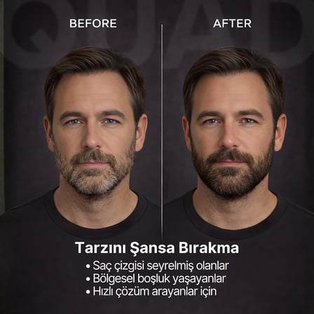 Saç Kapatıcı Pudra, Kahverengi, Unisex Saç ve Sakal Dolgunlaştırıcı, Doğal Görünüm, 12gr