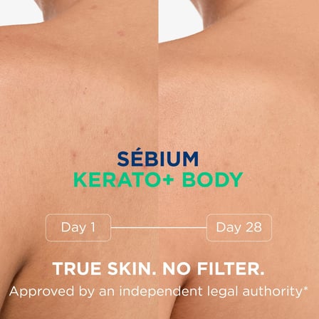 Bioderma Sebium Kerato+ Body Sivilce ve Akne Lekesi Karşıtı Ferahlatıcı Vücut Spreyi 150 ml