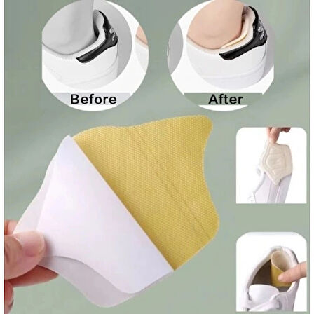 Topuk Daraltma Ve Vurma Önleyici 10 Mm Ayakkabı Pedleri