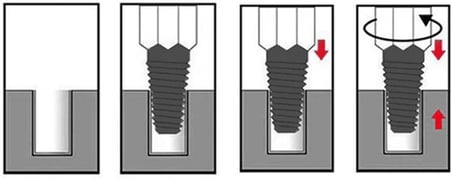 ® Ters Dişli Kılavuz Boru Sökme Aparatı – 1/2" ve 3/4" Hasarlı Paslı Boru &amp; Kırık Vida Çıkarıcı Spiral Takımı Geri Sarma Anahtarı, Metal İç Diş Temizleme Aleti (M25-M50)