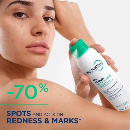 Bioderma Sebium Kerato+ Body Sivilce ve Akne Lekesi Karşıtı Ferahlatıcı Vücut Spreyi 150 ml