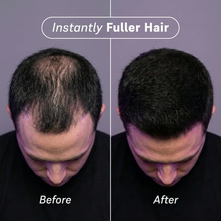 Saç Dolgunlaştırıcı Keratin Toz Fiber - Siyah