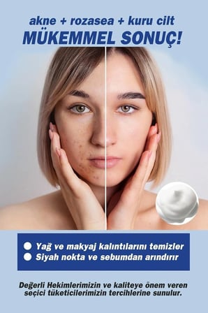 TTO Thermal Aplikatörlü Yüz Temizleme Köpüğü 200 ml