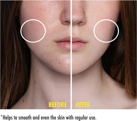 Niacinamide Cilt Serumu 30 ml