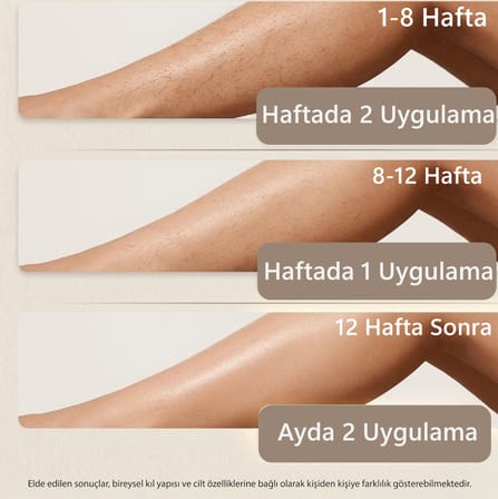 Robx A2030 IPL Sapphire Sogutma 35 joule Ultra Güç Hızlı Etki Çoklu Seri Otomatik Atım Pembe