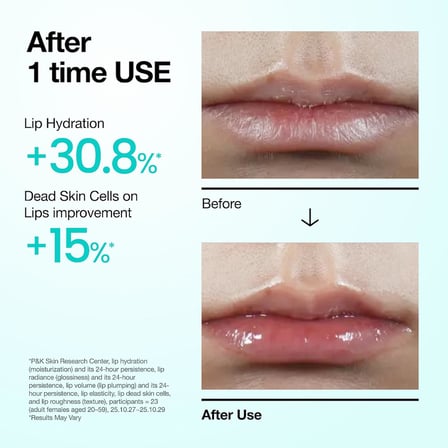 ANUA PDRN Lip Serum
