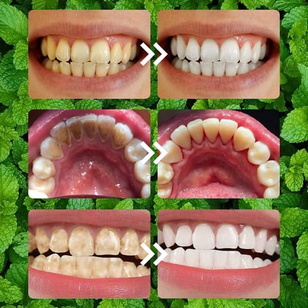 Oralhoe Teeth Restoration Mineral Powder Tooth Restoration Mineral Powder 50g