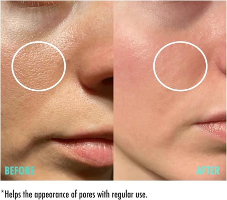 Gözenek Sıkılaştırıcı Cilt Serumu 30 ml