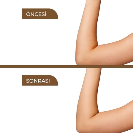 Karınca Yumurtası Yağı Tüy Azaltıcı Bakım Serumu, Tüy Dökücü, Batık Önleyici, Hassas Ciltler için, Yüz ve Vücut