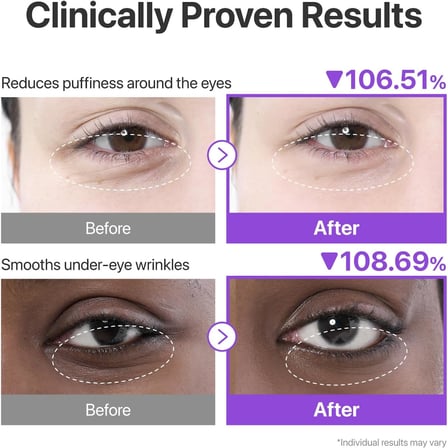 No.9 NAD+ Collagen Gel Eye Patches- Peptid, Kafein ve Niasinamidli Göz Altı Jel Pedleri 5 Çift