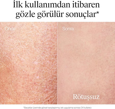 Yağ İle Zenginleştirilmiş Vücut Losyonu 400 ml — Badem yağı ile zenginleştirilmiş — Pro-Seramid teknolojili nemlendirici losyon
