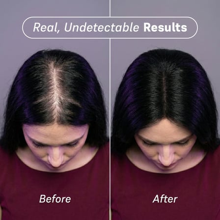 Saç Dolgunlaştırıcı Keratin Toz Fiber - Siyah