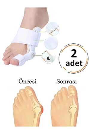 2'li Atel Ayak Parmak Başparmak Düzeltici Kemik Çıkığı Düzleştirici Taraklı Ayaklar Için Aparat