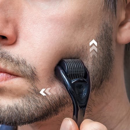 Derma rulo 1.0mm, 540 titanyum Microneedle rulo yüz yüz kırışıklıkları için saç dökülmesi streç işaretleri saç büyütme mikro iğneler profesyonel Microneedling Derma iğneleme kiti kılıf ile
