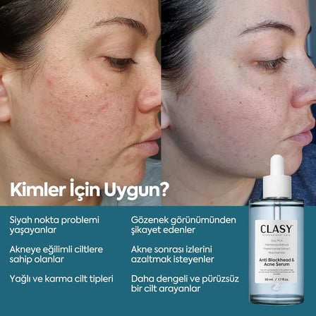 Niacinamide Yüz Serumu – Gözenek Görünümünü Sıkılaştırmaya ve Yağ Dengesini Desteklemeye Yardımcı – Siyah Nokta &amp; Leke Görünümü İçin Aydınlatıcı Bakım Serumu, 50 ml