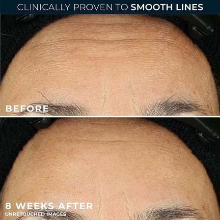 Retinol Correxion Line Smoothing Kırışıklık Karşıtı Kapsül Serum 10 Adet