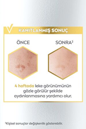 Nivea Luminous630 Leke Karşıtı Aydınlatıcı Cilt Bakım Serumu 30ml, Hyaluronik Asit, Cilt Tonu Eşitleyici