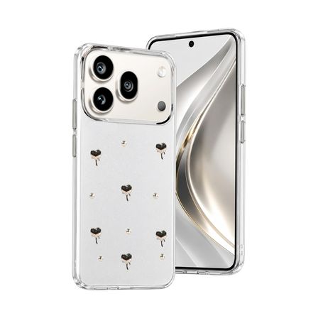 Newface Huawei Honor 600 Pro Fiyonk Desenli Kapak - Desen 1