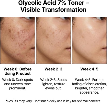 Maruderm Glikolik Asit%7 Aydınlatıcı ve Leke Görünümü Karşıtı Tonik – Meyan Kökü &amp; Hyaluronik Asit ile Pürüzsüzleştirici Peeling Tonik, 250 ML