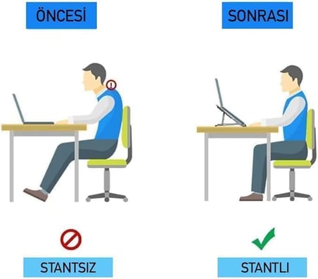 Taşınabilir Laptop Standı Macbook Standı Notebook Standı Tüm Laptoplarla Uyumlu Bilgisayar Standı Taşınabilir Metal Kaymaz Standı Dizüstü Bilgisayar Stantları Stant Stand