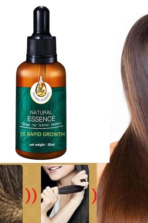 Natural Ginger 30 ml Zencefil İçerikli Saç Bakım Serumu – Besleyici Saç Bakımı